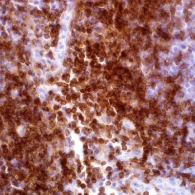 آنتی بادی CD4 کلون EP204 برند PathoSage