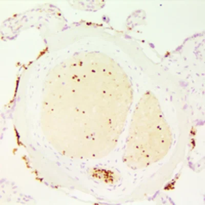 آنتی بادی CD42b کلون 42C01 برند PathoSage