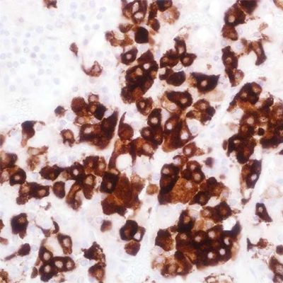 'Sage IHC AntiBody TSH(Thyroid Stimulating Hormone) Clone EP254