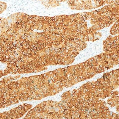 'Sage IHC AntiBody Uroplakin 2 Clone BC21