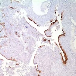 'Sage IHC AntiBody Uroplakin 3 Clone BC17