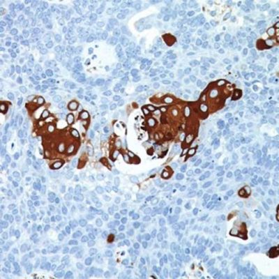 'Sage IHC AntiBody VEGF(Vascular Endothelial Growth Factor) Clone EP1176Y