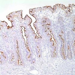 'Sage IHC AntiBody Villin 1 Clone CWWB1