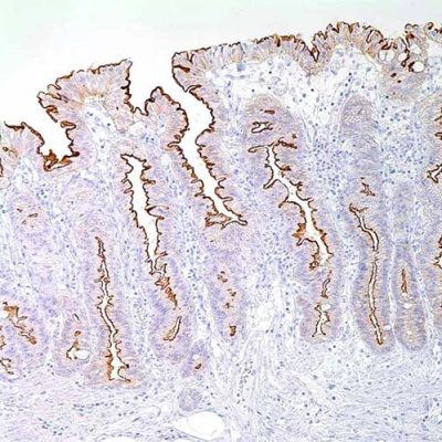 'Sage IHC AntiBody Villin 1 Clone CWWB1