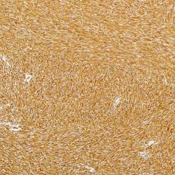 'Sage IHC AntiBody Vimentin Clone SP20