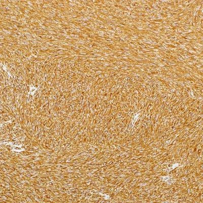 'Sage IHC AntiBody Vimentin Clone SP20