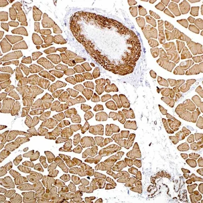 آنتی بادی Actin Muscle Specific کلون HHF35 برند PathoSage