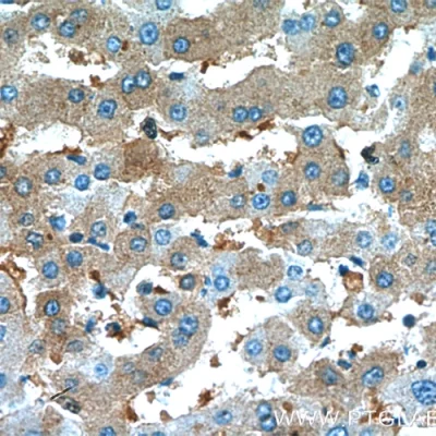 آنتی بادی Alpha1 Antitrypsin کلون Polyclonal برند PathoSage