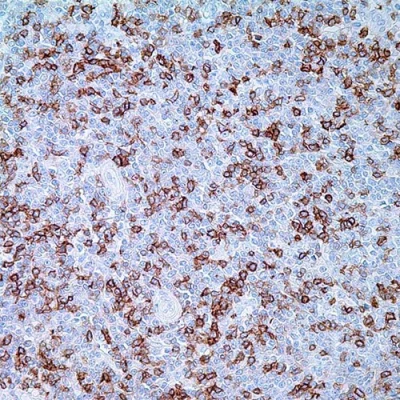 آنتی بادی CD5 کلون 4C7 برند PathoSage