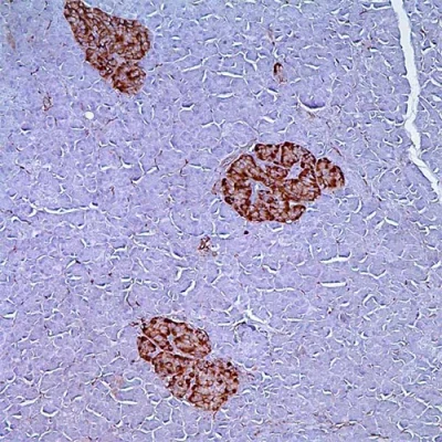 آنتی بادی CD56(NCAM-1) کلون MX039 برند PathoSage