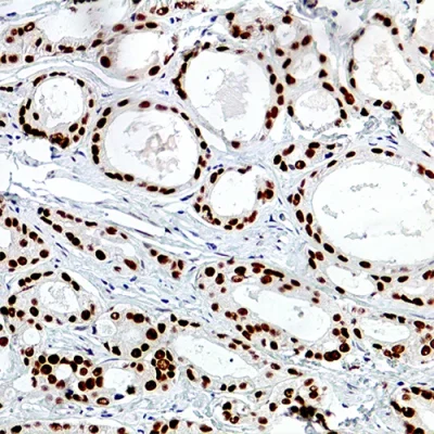 آنتی بادی AR(Androgen Receptor) کلون EP120 برند PathoSage