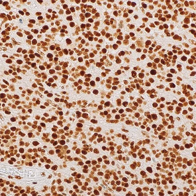 آنتی بادی ATRX کلون Polyclonal برند PathoSage