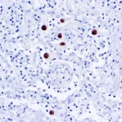 آنتی بادی CMV(Cytomegalovirus) کلون DDG9/CCH2 برند PathoSage