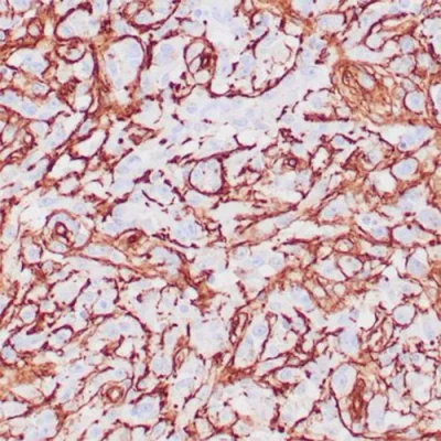آنتی بادی Collagen 4 کلون COL4/4241R برند PathoSage