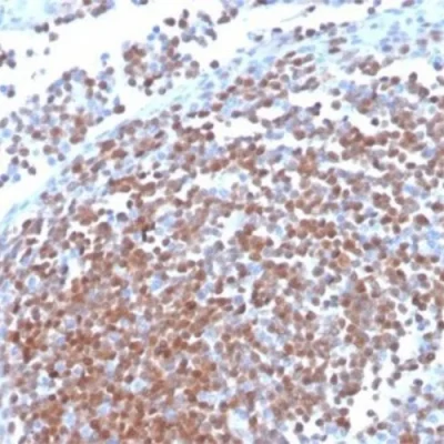آنتی بادی Cyclin D1 کلون CCND1/3370R برند PathoSage