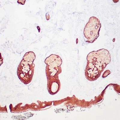 آنتی بادی Cytokeratin کلون 34BE12 برند PathoSage