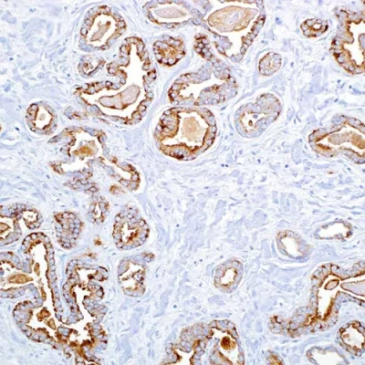 آنتی بادی Cytokeratin کلون AE1 برند PathoSage
