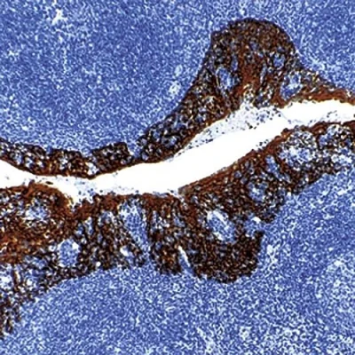 آنتی بادی Cytokeratin کلون MNF116 برند PathoSage