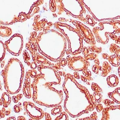 آنتی بادی Cytokeratin 18 کلون DC10 برند PathoSage