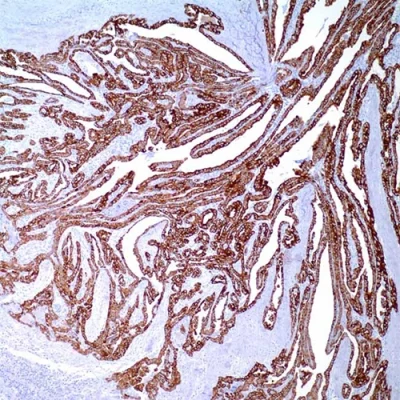آنتی بادی Cytokeratin 19 کلون A53-B/A2.26 برند PathoSage