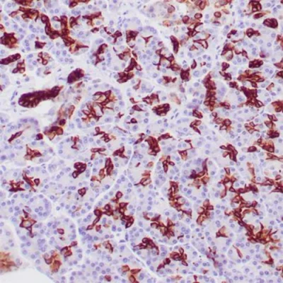 آنتی بادی Cytokeratin 19 کلون BA17 برند PathoSage