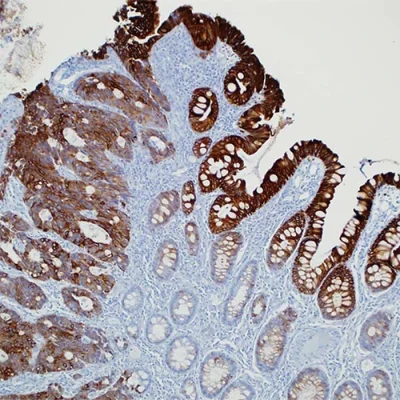 آنتی بادی Cytokeratin 20 کلون KS20.8 برند PathoSage