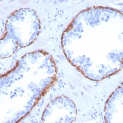 آنتی بادی Cytokeratin 5 کلون KRT5/3594 برند PathoSage