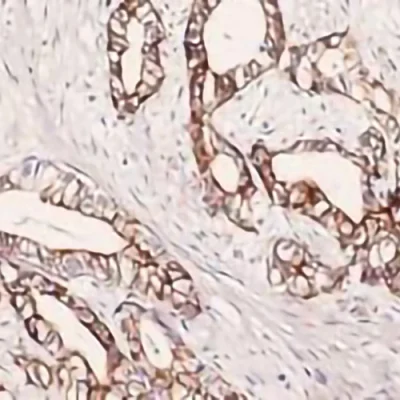 آنتی بادی Cytokeratin 7 کلون R17-S برند PathoSage