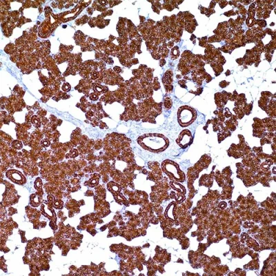 آنتی بادی Cytokeratin 8/18 کلون B22.1&B23.1 برند PathoSage