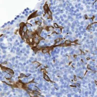 آنتی بادی Cytokeratin 8/18 کلون K8.8 + DC10 برند PathoSage