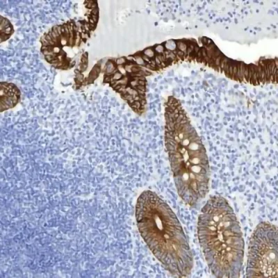 آنتی بادی Cytokeratin Cocktail کلون AE1+AE3+C11+DC10 برند PathoSage