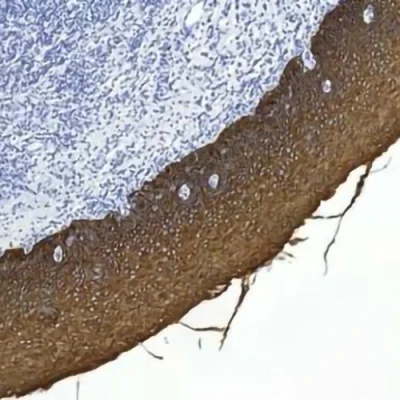 آنتی بادی Cytokeratin PAN کلون LU5 برند PathoSage