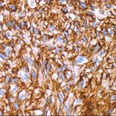 آنتی بادی DOG1(Anoctamin 1) کلون DOG1.1 برند PathoSage
