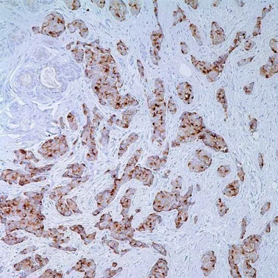 آنتی بادی EMA(Epithelial Membrane Antigen /MUC-1) کلون E29 برند PathoSage
