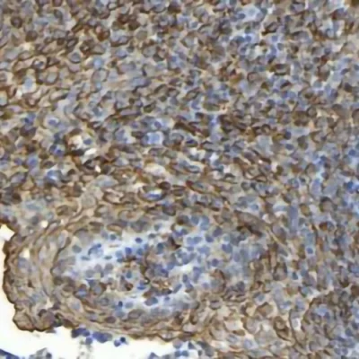 آنتی بادی EMA(Epithelial Membrane Antigen /MUC-1) کلون GP1.4 برند PathoSage