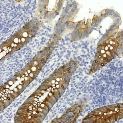 آنتی بادی ESA(Epithelial Specific Antigen) کلون BER-EP4 برند PathoSage