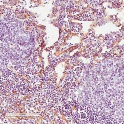 آنتی بادی Fibroblast کلون ER-TR7 برند PathoSage