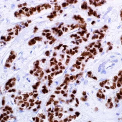 آنتی بادی GATA3 کلون L50-823 برند PathoSage