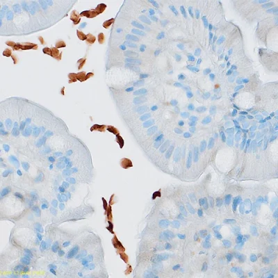 آنتی بادی Giardia Lamblia کلون Polyclonal برند PathoSage