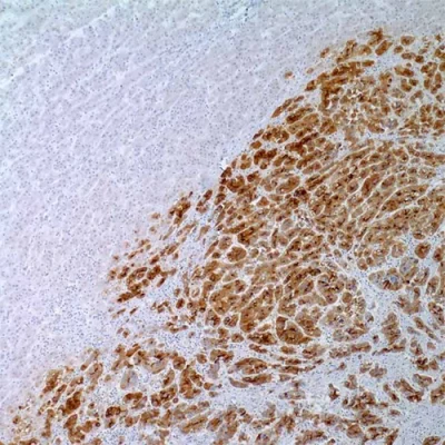 آنتی بادی Glypican 3 کلون 1G12 برند PathoSage
