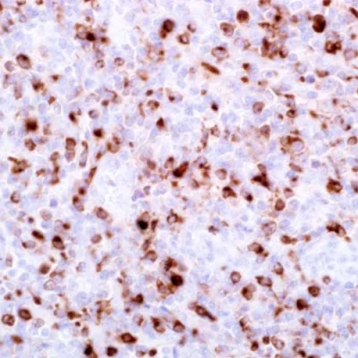 آنتی بادی Granzyme B کلون GrB-7 برند PathoSage