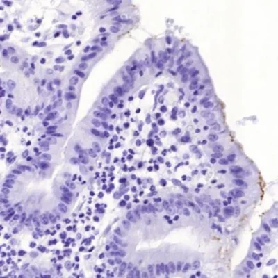 آنتی بادی Helicobacter Pylori کلون HPLY/7225 برند PathoSage