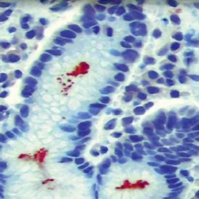 آنتی بادی Helicobacter Pylori کلون MX014 برند PathoSage