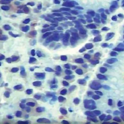 آنتی بادی Helicobacter Pylori کلون Polyclonal برند PathoSage