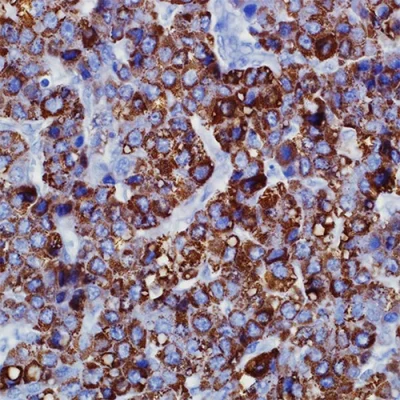 آنتی بادی Hep Par 1(Hepatocyte Specific Antigen) کلون OCH1E5 برند PathoSage
