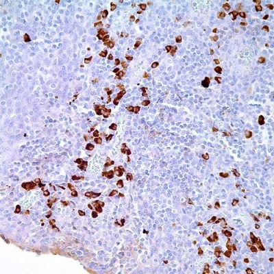 آنتی بادی Human IgA کلون Polyclonal برند PathoSage