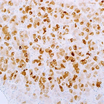 آنتی بادی Inhibin Alpha کلون INHA/4265 برند PathoSage