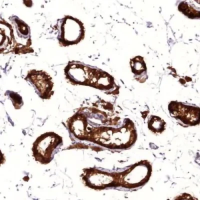 آنتی بادی Inhibin Alpha کلون MX098 برند PathoSage