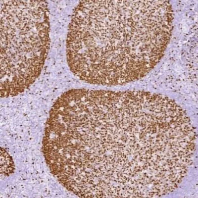 آنتی بادی KI67 کلون MXR002 برند PathoSage