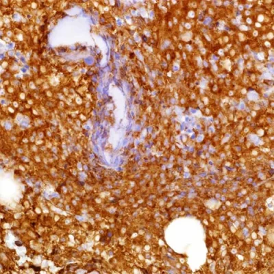 آنتی بادی Lambda Immunoglobulin Light Chain کلون LAMB14 برند PathoSage